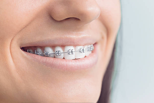 Best Traditional Braces  in Orange, OH